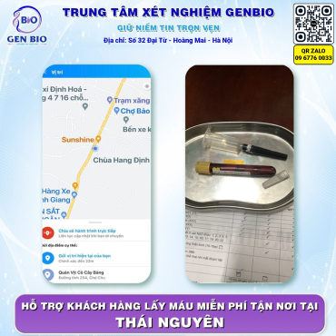http://xetnghiemgenbio.giaodiendep.com/wp-content/uploads/2024/08/9bab47869c02395c601350-1.png